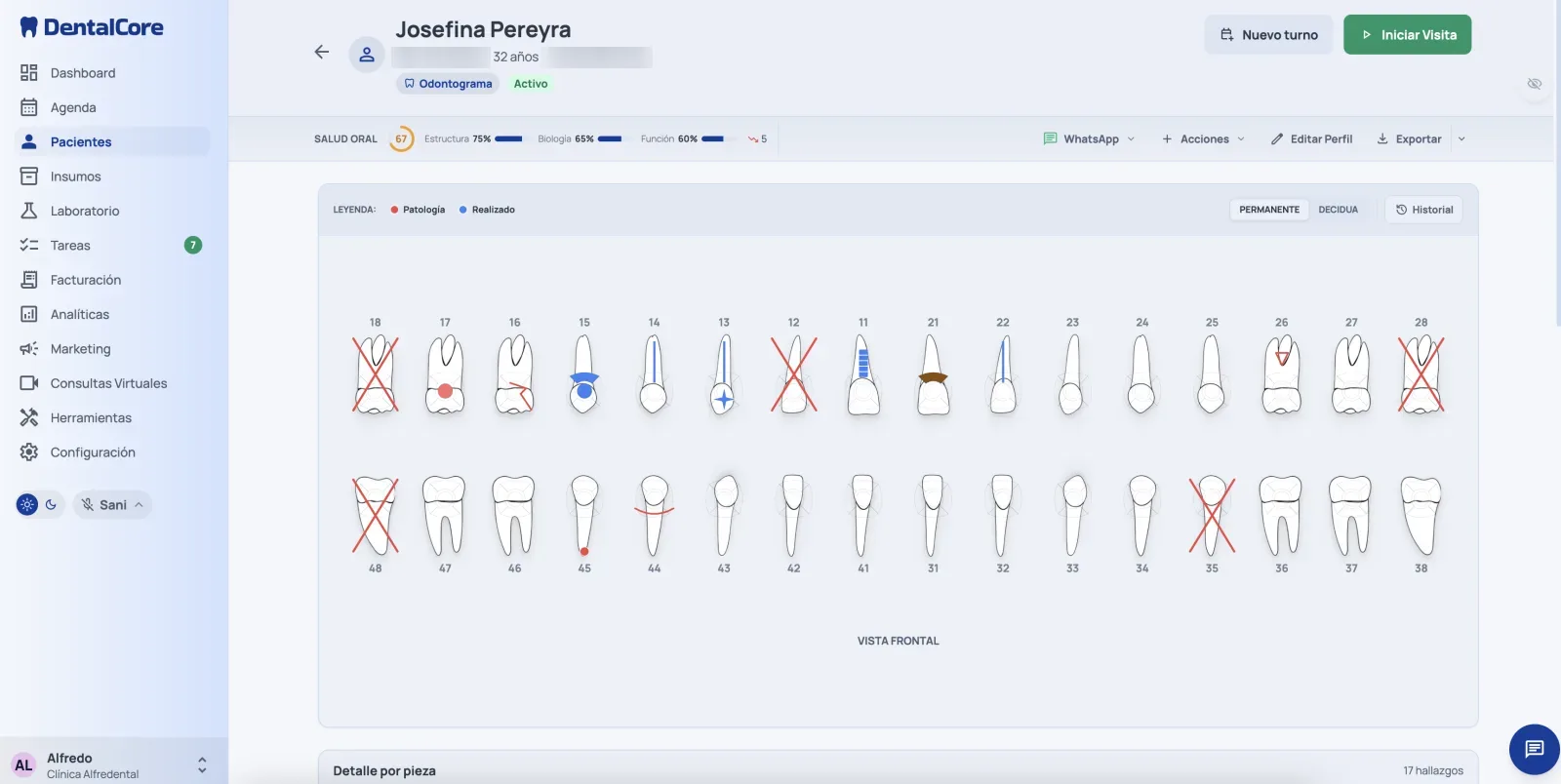 Odontograma digital — Atención Clínica